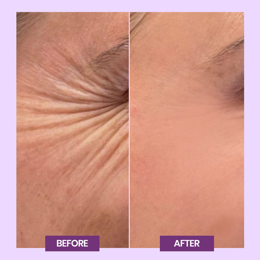 Retinol Intense Triple Action Cream