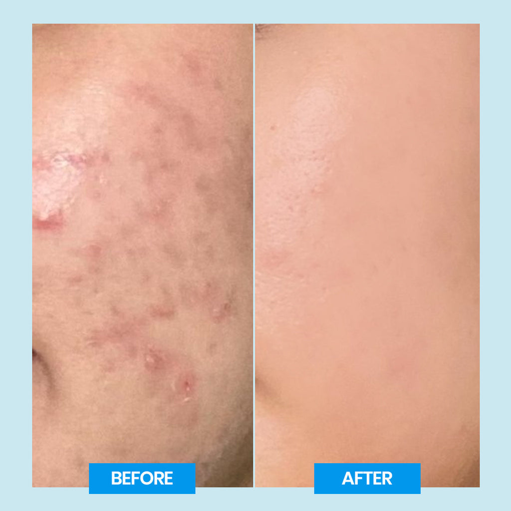 Mandelica Gentle Cleanser