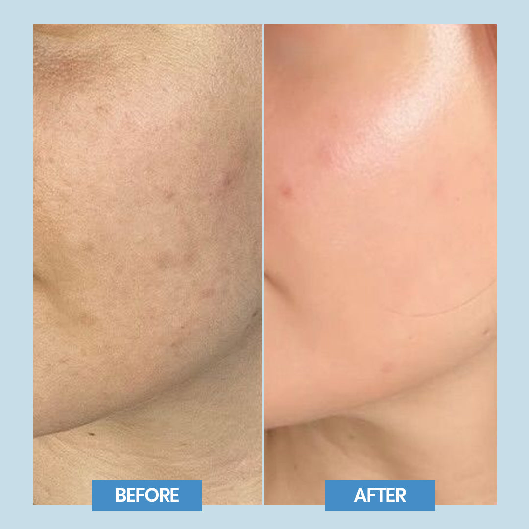 Ray Ban SC (Sebum Control Gel)